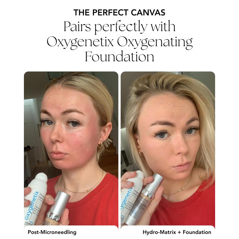 Oxygenetix Oxygenating Hydro-Matrix (1oz) | Lightweight Aloe-Based Face Moisturizer with