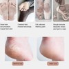 MARSKE Electric Feet Callus Removers Grinder Portable Foot File Pedicure