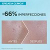 Garnier Super UV Protector Solar Facial Anti-Imperfecciones FPS 50+, con
