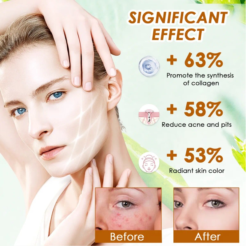 Solución Tonificante De Ácido Glicólico, Tónico, Cuidado De