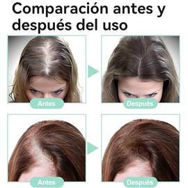Aceite De Romero：Aceite de Romero para El Cabello-100%, Aceite Esencial de Romero para Cabello ，Estimula el Crecimiento del Cabello, Ideal para Cejas,