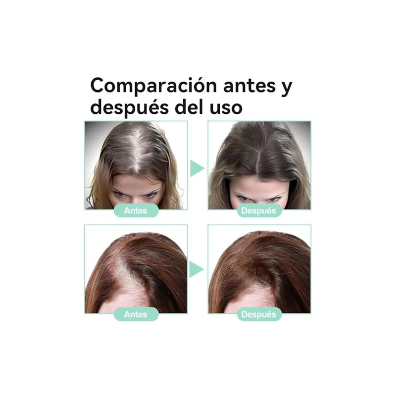 Aceite De Romero：Aceite de Romero para El Cabello-100%, Aceite Esencial