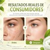 2PCS Vitamin C Booster Shot Serum, Sérum Facial