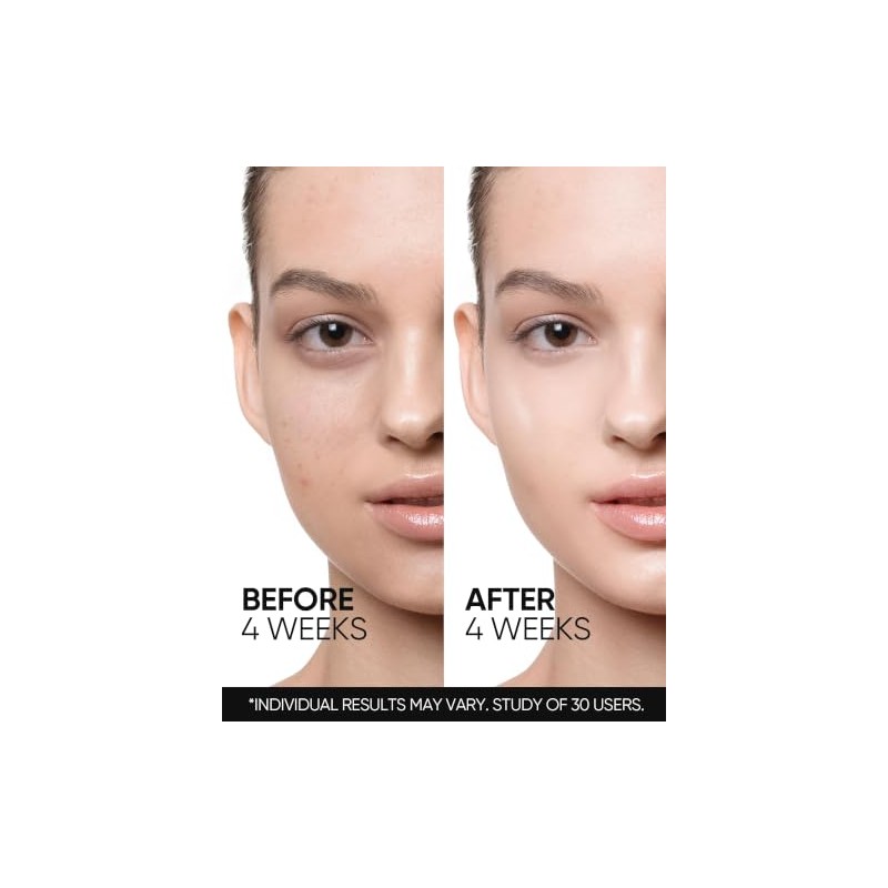 Retinol Skin Renewal Moisturizer