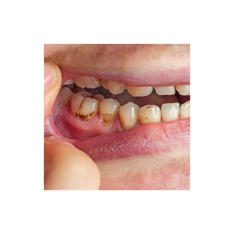 Pasta Dental Atomy Sensitive 100g Coreana Dientes Sensibles