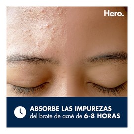 Parches para acné Hero Migthy Patch duo 12 piezas