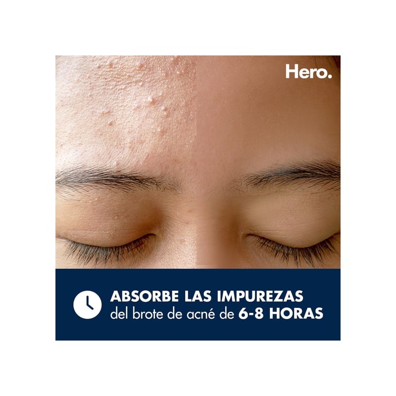 Parches para acné Hero Migthy Patch duo 12 piezas