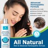 Roycederm Champú para la psoriasis, dermatitis seborreica, foliculitis y caspa,