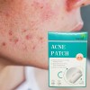 Parches Invisibles Acné Espinillas Facial Absorbente 72pz F