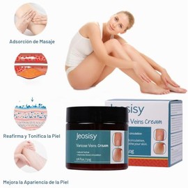 Crema para venas varicosas crema para venas varicosas en las piernas, crema calmante para venas varicosas y araas vasculares en las piernas           