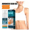 Crema Para Cicatrices En Gel Queloid Acne Removal Treatment,