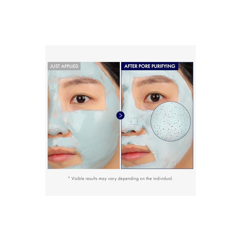 TOSOWOONG Real Blackhead Mud Mask, Facial & Nose Pore-Purifying Clay