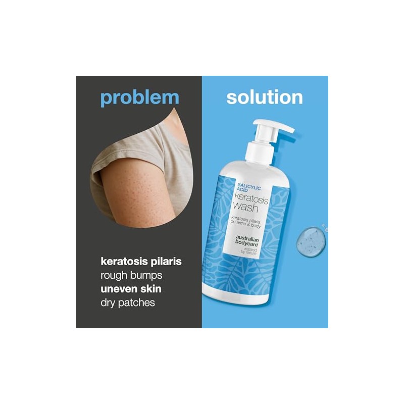 Keratosis Pilaris Body Wash – Targets Bumpy Skin, Strawberry Legs
