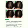 Some By Mi Cica Peptide Anti Hair Loss Derma Scalp
