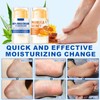 DMQ Urea Foot Cream, 2PCS Foot Cream for Cracked Heels