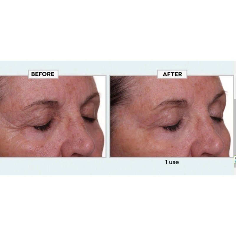 Nakery Beauty Lift-TOX 360 Firming Eye Lift Treatment Cream 1.01