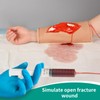 MedEduQuest Open Fracture Wound Packing Trainer, Wound Dressing Training Model,