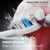 Aquasonic Vibe Series PRO – Ultra-Whitening Electric Toothbrush – 5