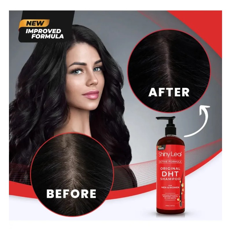 Dht Blocker Champú Anti-pérdida De Cabello Con Biotina