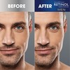 Retinol Men’s Eye Cream – The Original Retinol Eye Treatment