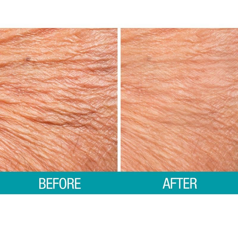 Dermactin-TS Crepe Be Gone Firming Neck Cream 3 oz.