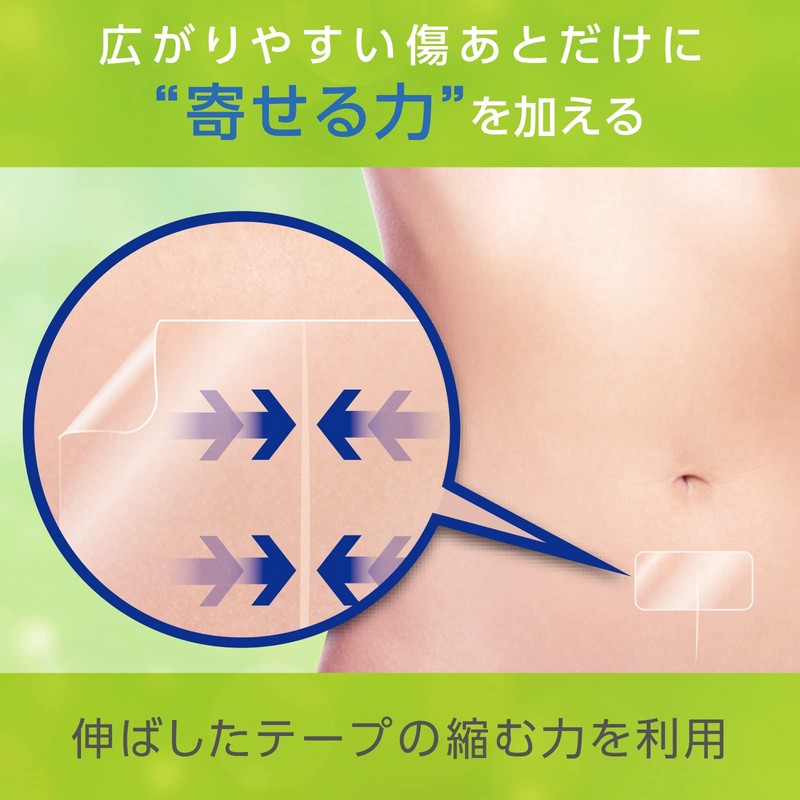 atoresukea YB – q2550s 1 Box 30 Pieces 25 mm50 mm