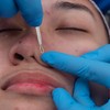 Kit de Herramientas de Acero Inoxidable para Limpieza Facial y