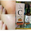 SERUM VITAMINA C