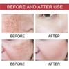 Generic Upgraded Body Care Essence Oil - Moisturizing Facial Essence