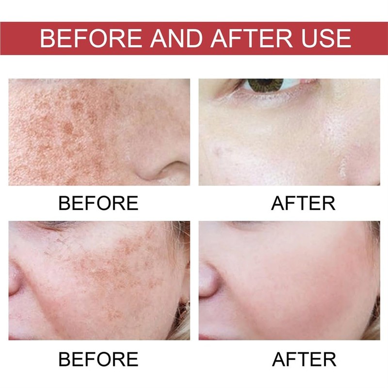 Generic Upgraded Body Care Essence Oil - Moisturizing Facial Essence
