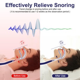 Anti Snoring Devices,Electric Stop Snoring Solution,Mini Portable Anti Snore Device,Adjustable Wind Speed Snoring Prevention for Men Women Sleep Travel,White
