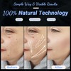High Frequency Facial Wand - UUPAS Portable Handheld 4 in