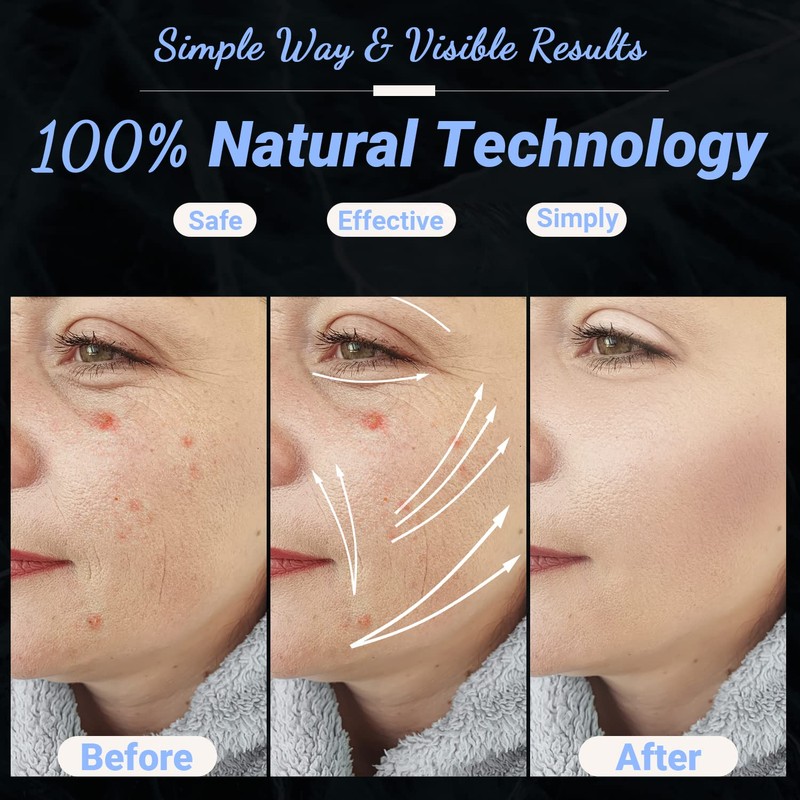 High Frequency Facial Wand - UUPAS Portable Handheld 4 in