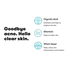 Proactiv Hydrating Facial Toner For Sensitive Skin - Alcohol Free Toner Skin Care - Pore Tightening Glycolic Acid and Witch Hazel Toner Formula - Balance Skin And Remove Impurities, 120 ml