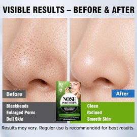 Shaeva Natural Charcoal Pore Strips Blackhead Remover Strawberry Nose Deep Clean and Shrink Smoothing for Oily Skin (10 Pieces) / 셰바 내추럴 숯 모공 스트립 블랙헤드 리무버 지성 피부용 딸기 코 딥 클린 및 수축 스무딩 (10개)