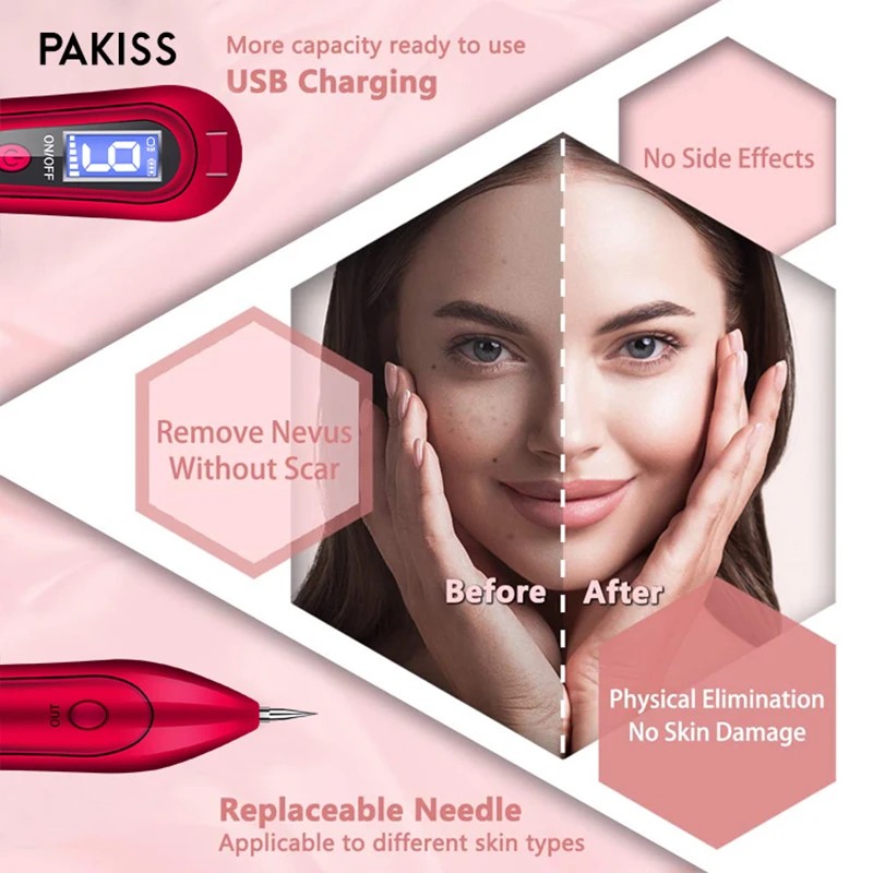 PAKISS FY-104 Advanced Beauty Pen Technology - Safe, Effective &