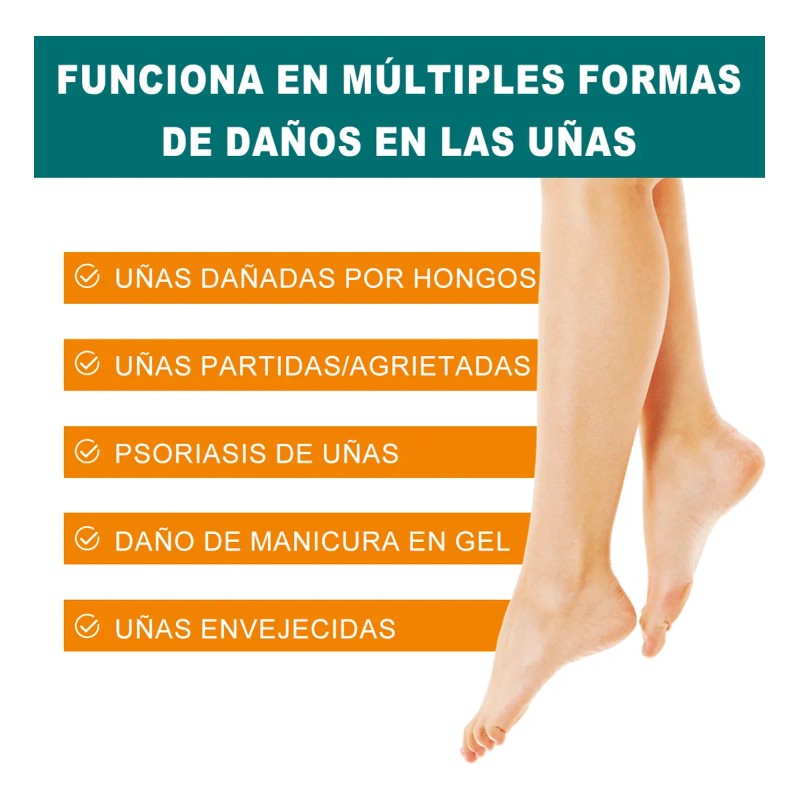 Ungüentopara Hongo De Uñas Elimina Eficazmente Los Hongo