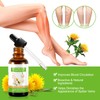 Varicose Veins Essential Oil, Spider Vein Removal Oil for Legs,