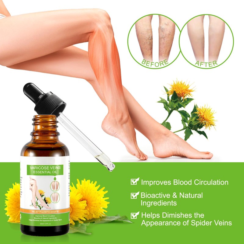 Varicose Veins Essential Oil, Spider Vein Removal Oil for Legs,