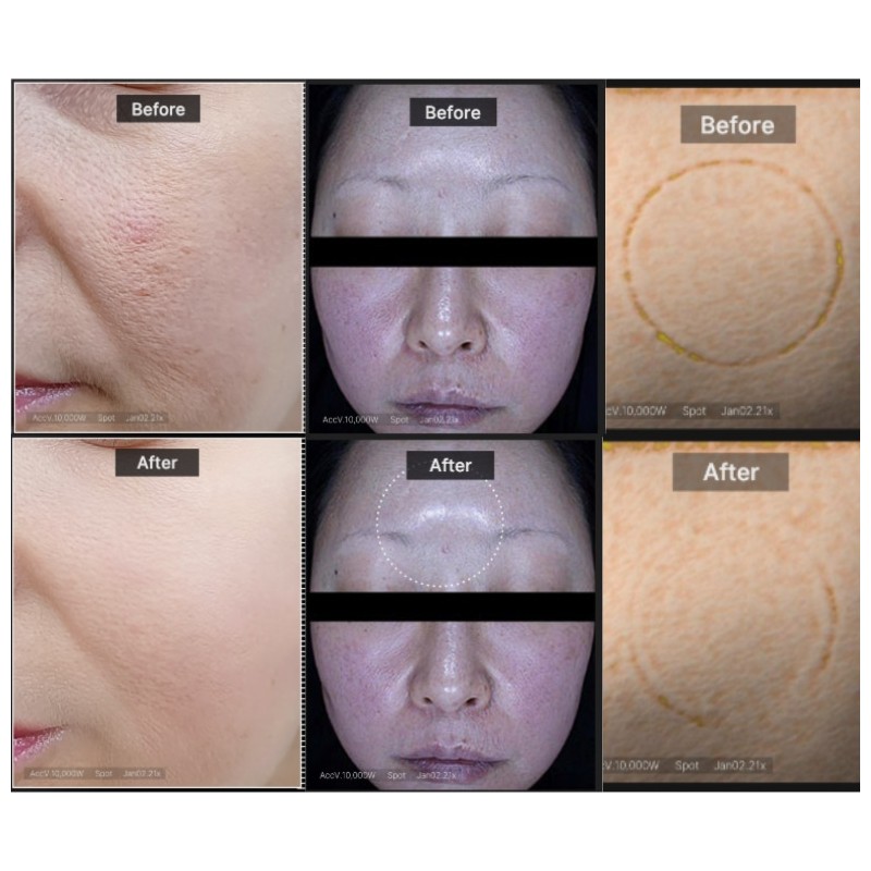 MEDICUBE Collagen Night Wrapping Mask 75ml, Type:02 Collagen Night Wrapping