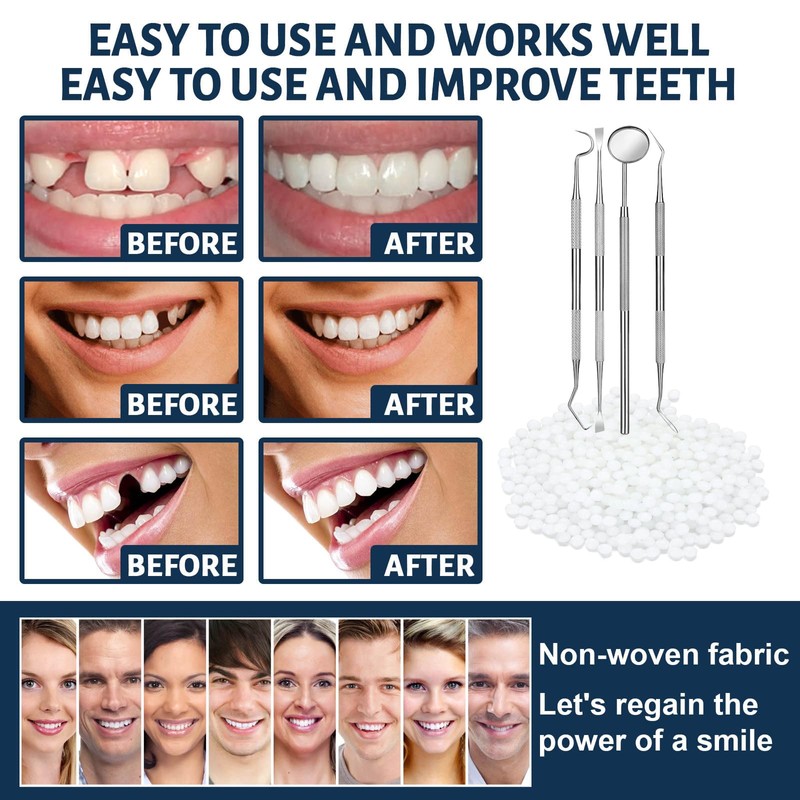 Tooth Repair Kit - Temporary Fake Teeth Replacement Kit with