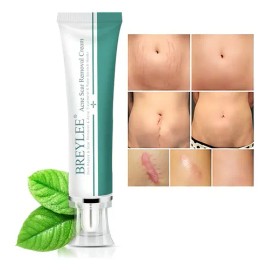Breylee | Crema Elimina Estrías, Cicatrices, Acné Y Manchas