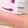 Kosmetex Pink Wax Cartridges, Hair Removal, Roll-On Wax Roller, Warm