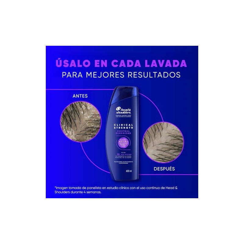 HEAD & SHOULDERS, Shampoo para Caspa, Clinical Strength Control Oleosidad