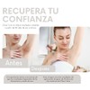 Clear Tone Crema Despigmentante 50g - Manchas Solares, Edad y