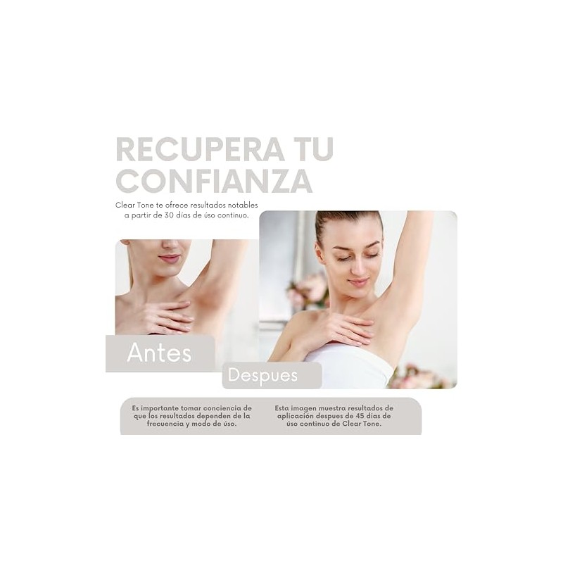 Clear Tone Crema Despigmentante 50g - Manchas Solares, Edad y