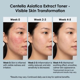 Maruderm Centella Asiatica Facial Toner with Hyaluronic Acid, Panthenol & Ceramides - Soothing & Moisturising Toner Serum | Cruelty Free & Vegan, 250 ml