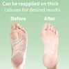 Dr. Entre's Callus Remover Gel & Foot File: Extra Strength