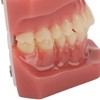 Tooth Model 28 Teeth Dental Orthodontic Model Teaching Study Supplies