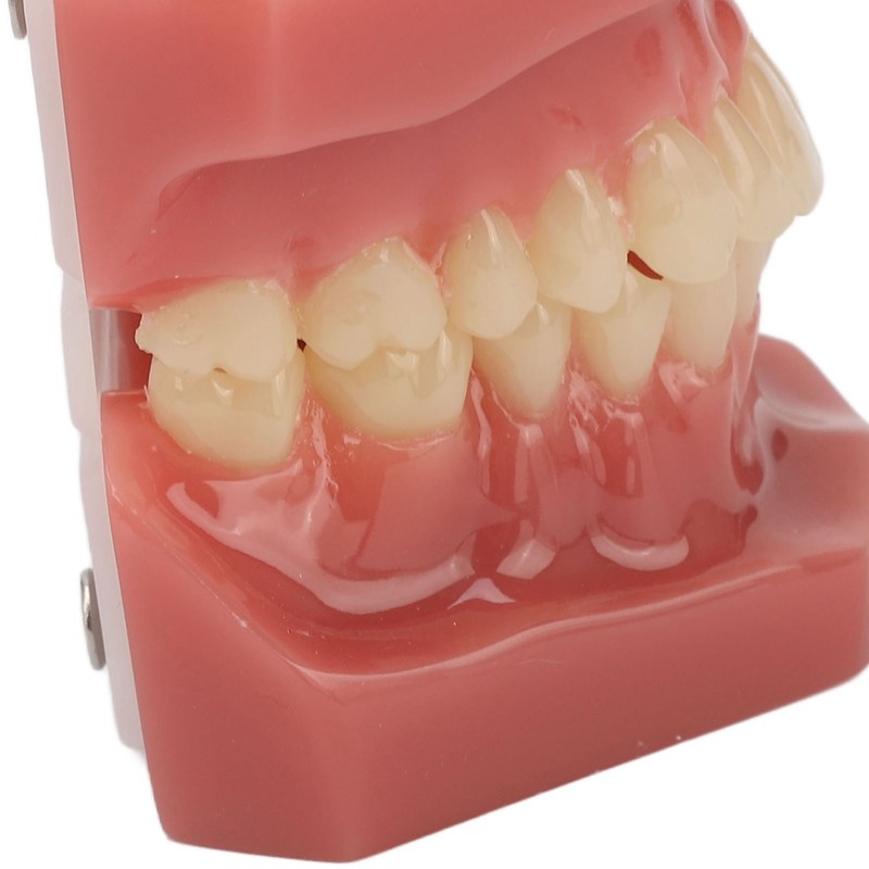 Tooth Model 28 Teeth Dental Orthodontic Model Teaching Study Supplies